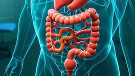 肠穿孔患者必读：手术麻醉管理全攻略