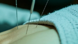 科普，针灸与<span style="color: #da4707">免疫调节</span>：古老疗法的新发现
