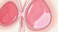 揭开乳腺肿瘤切除术的神秘面纱:全面解析与康复指南
