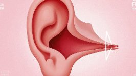 科普，听力<span style="color: #da4707">重建</span>手术：重拾声音的希望与未来展望