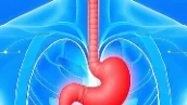解锁食管支架置入术:优化吞咽体验与改善生活质量