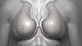 乳腺癌早期信号与防控指南