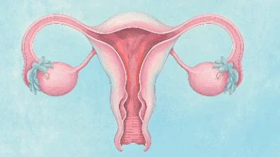 宫颈癌早发现可预防:女性必读健康指南