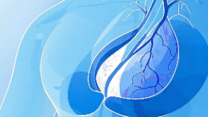 科普，乳腺癌早防早治：女性必知的健康指南封面图