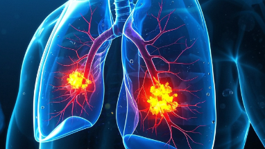 科普，<span style="color: #da4707">肺癌</span>全景解析：病因、症状与有效<span style="color: #da4707">预防</span><span style="color: #da4707">策略</span>