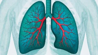 肺癌早发现早治疗:识别症状与科学预防指南