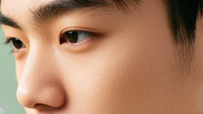 青春痘不再烦恼：青少年痤疮的预防攻略