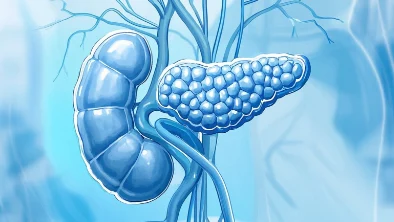 胰腺癌危机:识别症状与防控指南