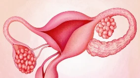 当幸福的路被堵：深入了解输卵管堵塞的症状、原因与治疗