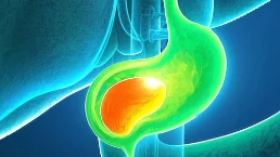 胆管癌:早期识别与防控指南,守护健康