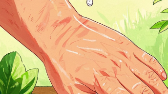 科普，<span style="color: #da4707">皮肤</span><span style="color: #da4707">瘙痒</span>：你不知道的原因与应对之道