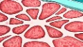 乳腺纤维腺瘤:年轻女性乳房健康的关键知识