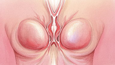 科普，乳腺癌早发现，女性必读的防治指南封面图