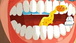 清新口气，从根本开始：揭秘口臭的背后