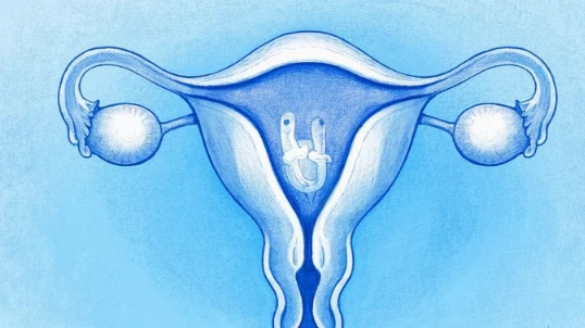 宫颈癌的全景解析：从诊断到康复的科学指南