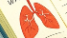 科普，肺结核：潜藏在<span style="color: #da4707">人类</span>肺部的敌人及其防控全解析