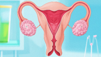 科普，卵巢癌早期信号识别与预防指南 | 女性健康必读封面图