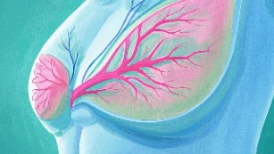 乳腺癌早期信号识别与应对指南