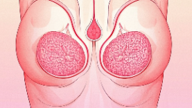 科普，乳腺癌防治：识别信号与科学方法封面图