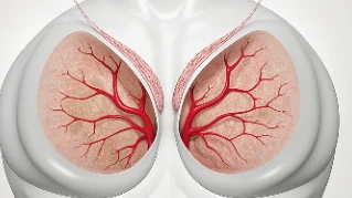 乳腺癌治疗指南:选择合适药物,保障安全用药