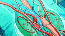科普，走近<span style="color: #da4707">精索静脉曲张</span>：男性健康的隐患与治疗策略