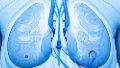 乳腺癌全攻略:发现、治疗与康复的实用指南