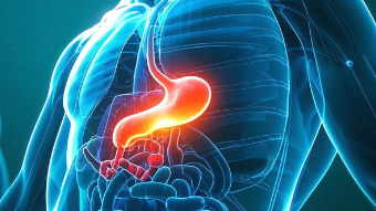科普,胃癌:一场不可忽视的健康危机封面图