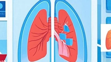 如何有效管理和治疗尘肺?