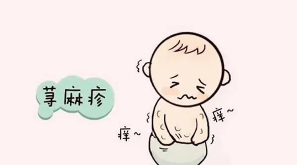荨麻疹:从病因到管理,你需要了解的一切