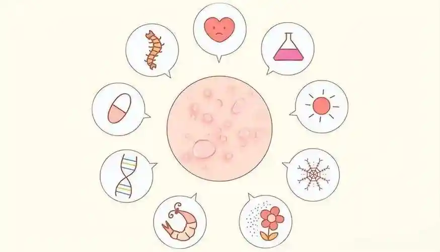 了解药物科学使用，远离皮肤健康困扰—枸地氯雷他定与神经性皮炎的深入探讨！封面图