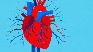 破解心脏迷局:了解急性心肌梗死的再灌注治疗