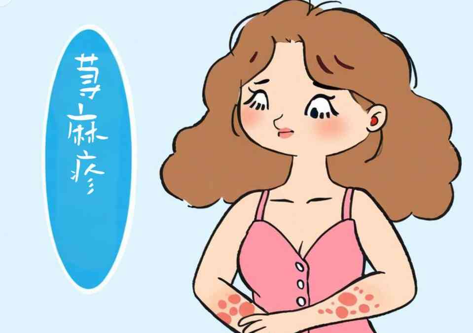 慢性荨麻疹知多少？——给你的皮肤健康上一课！封面图