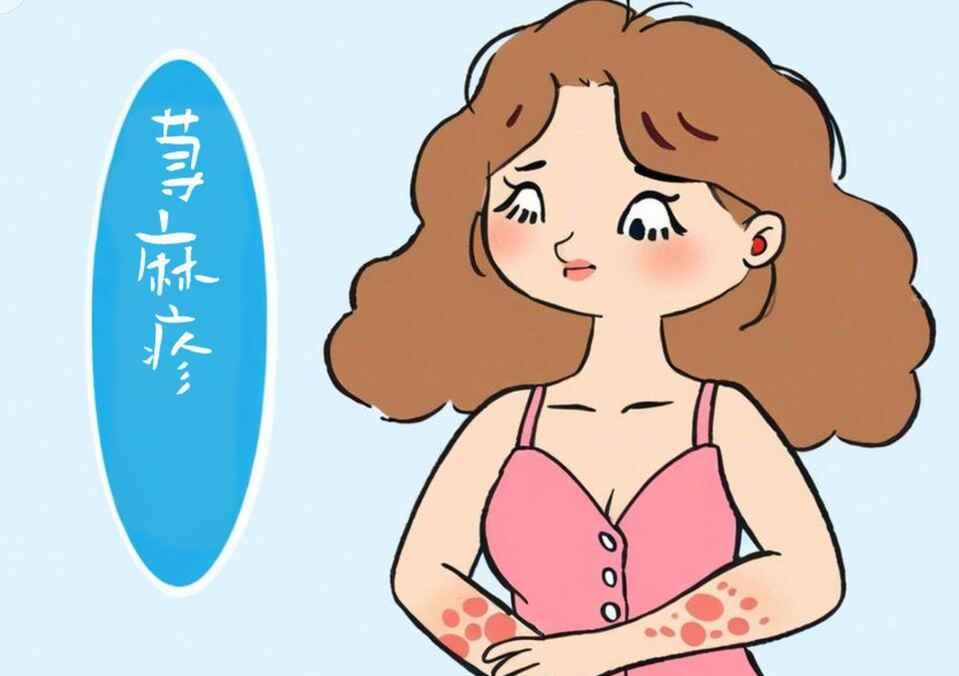 科普，慢性荨麻疹知多少？——给你的皮肤健康上一课！封面图