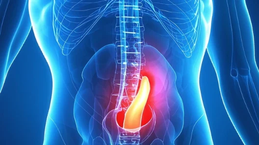 单侧腹股沟疝的全面指南:类型、诊断、治疗及生活调整