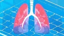 走出阴霾：肺癌临床分期3的全面治疗与康复之道
