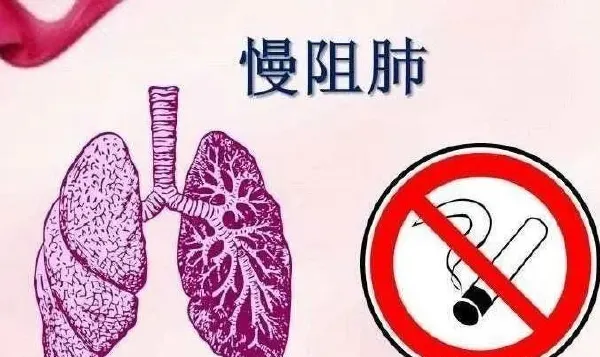 全面了解慢性阻塞性肺病及其管理