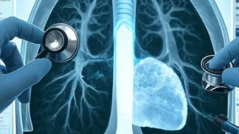 孤立性肺结节:你不可忽视的健康警讯!
