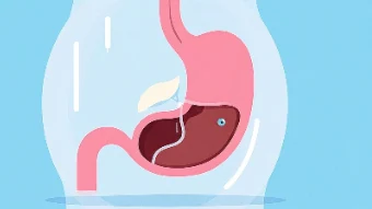 胃癌早发现的重要性及症状识别方法