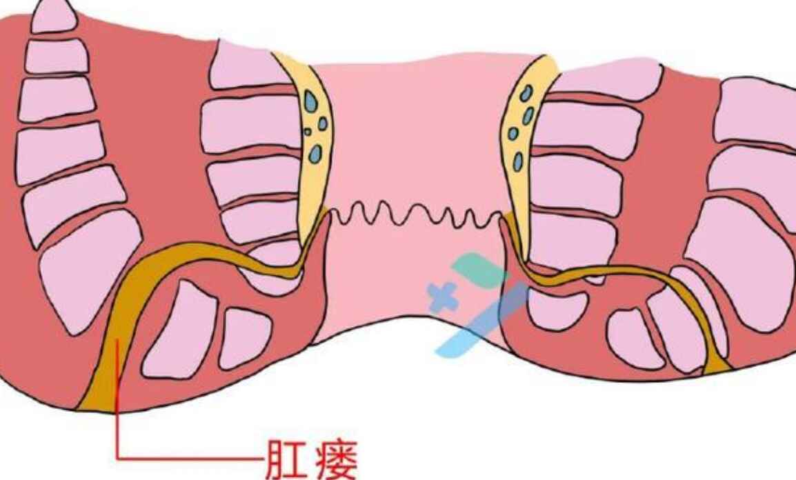 科普，肛瘘：别让它<span style="color: #da4707">影响</span>你的<span style="color: #da4707">健康</span>生活！