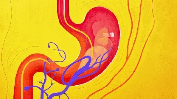 突破肿瘤迷雾:解剖cT4NXMO胃恶性肿瘤的精准治疗与生存预后