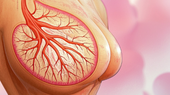 科普，“狙击”乳腺癌ⅱ期：精准治疗指南全解析封面图
