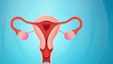 子宫内膜癌的信号与预防：女性必看护理指南