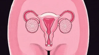 探秘隐秘的子宫腺肌瘤：了解症状与治疗选择