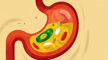 胃癌早期知多少?--别让饮食毁了健康!