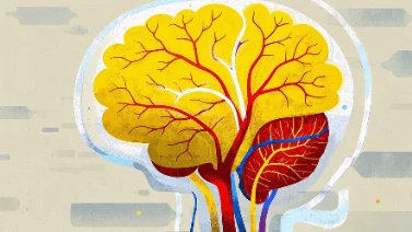 颅内出血手术：麻醉管理与早期信号重要性