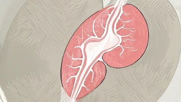 别让隐形杀手偷袭——认识乳腺癌并科学预防!