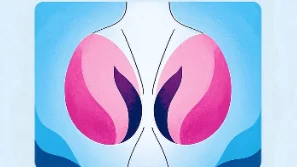 乳腺纤维瘤的科学解读：分类、诊断及管理策略