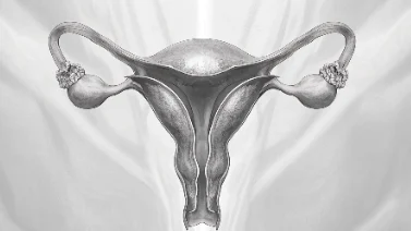 卵巢癌早期信号解读:女性必读