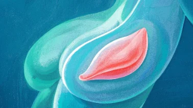 乳腺癌:女性健康的早期信号与科学防护
