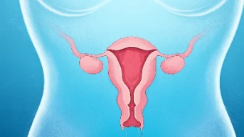 女性健康守护者:全面解析卵巢癌的诊断与预防